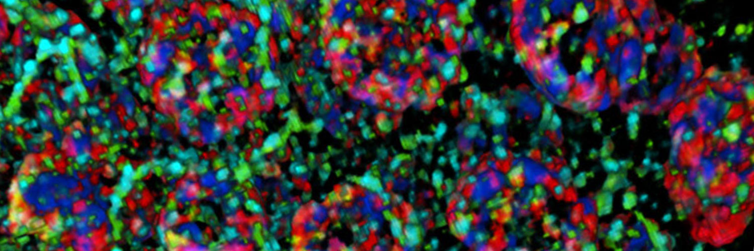 Photo of c-elegans